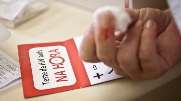 Tempo de vida de pessoas com HIV mais que dobra no Brasil