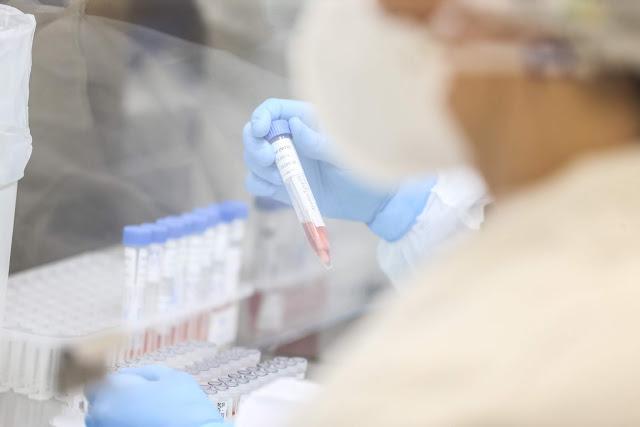 Covid-19: Toledo confirma mais 13 casos e chega a 135
