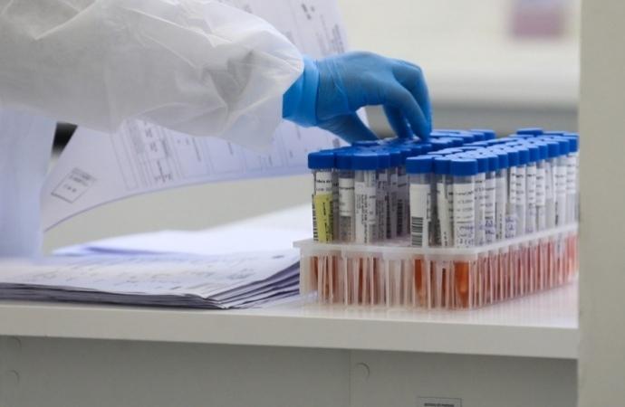 Santa Helena confirma primeiro caso de Influenza A H3N2