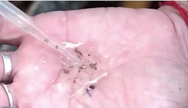 Foz do Iguaçu confirma a quarta morte por dengue em 2023