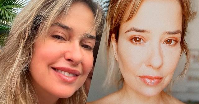 Paloma Duarte explica inchaço no rosto e rebate críticas: 'Processo cirúrgico e isso não é da conta de ninguém'