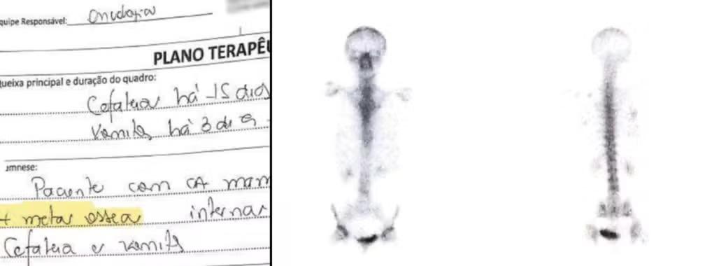 Por erro médico, mulher trata câncer inexistente durante 6 anos