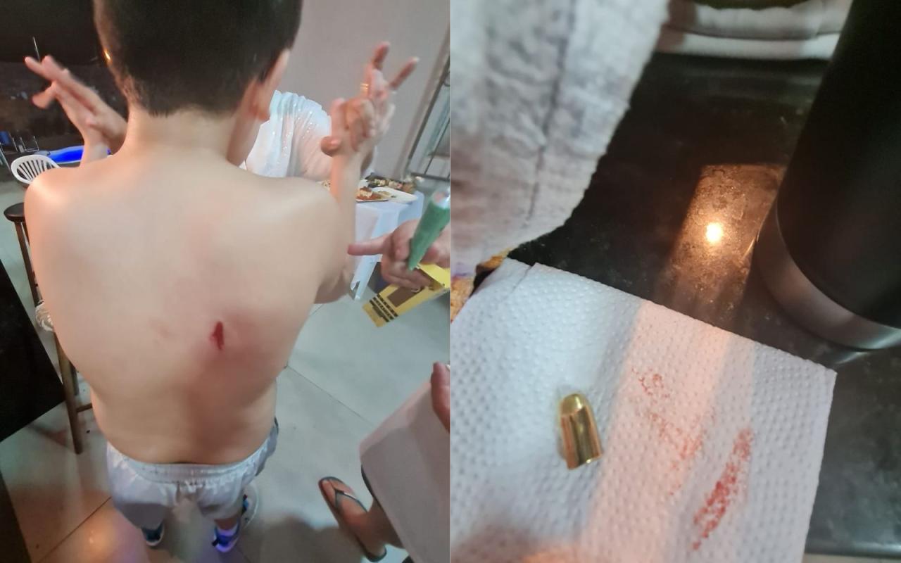 Adolescente é atingido dentro de casa por bala perdida na noite de réveillon em Foz