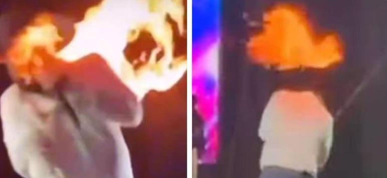 Rosto do cantor sertanejo Léo pega fogo durante show