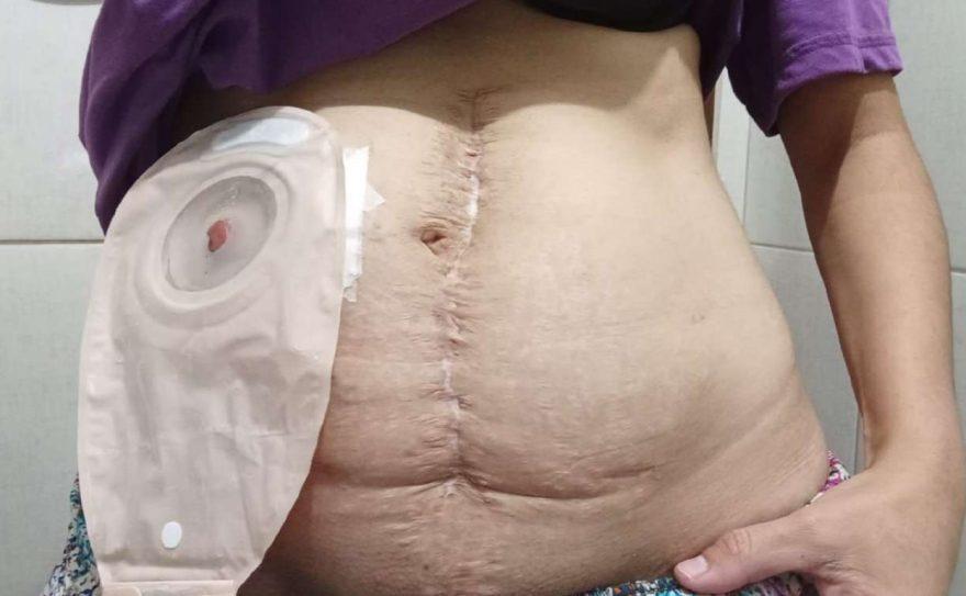 Mãe denuncia histórico de negligência após perder bebê e o intestino