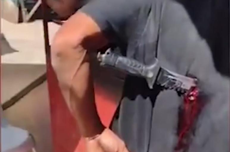 Homem fica com faca cravada nas costas após tentativa de homicídio