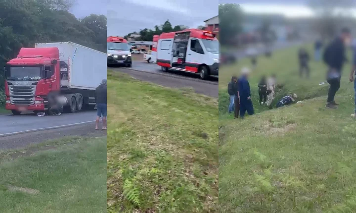 Gestante tem perna amputada após ser atropelada por moto ao atravessar a rua